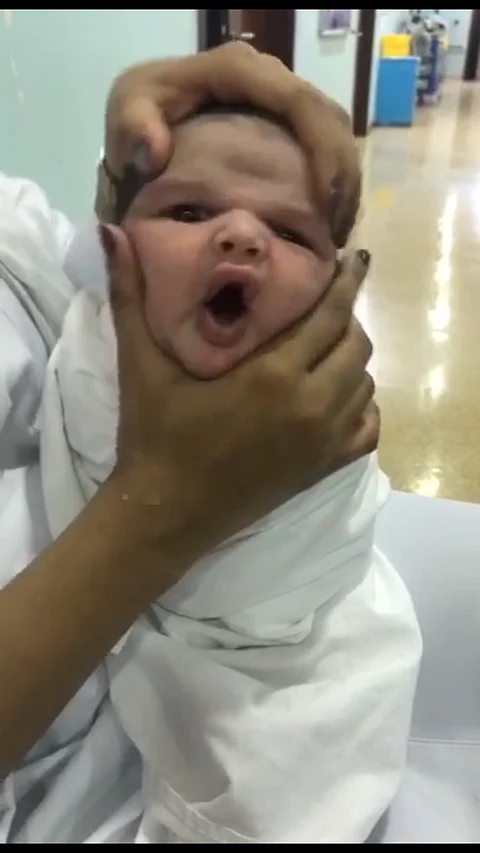 إيقاف 3 ممرضات عن العمل أسأنَ لطفل رضيع في مقطع فيديو بالطائف
