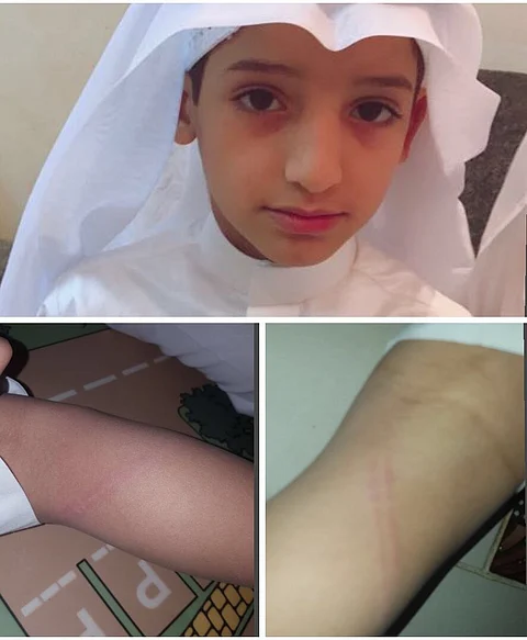 تعليم الليث عن شكوى تعرض طالب للعقاب البدني: الموضوع تحت الإجراء