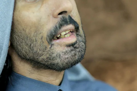شاهد .. مريض يشكو من إهمال طبي أفقده الكلام والأكل والشرب