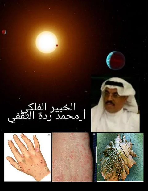 فلكي: غبار الربيع ينقل الفيروسات والأمراض كـ"الجرب"