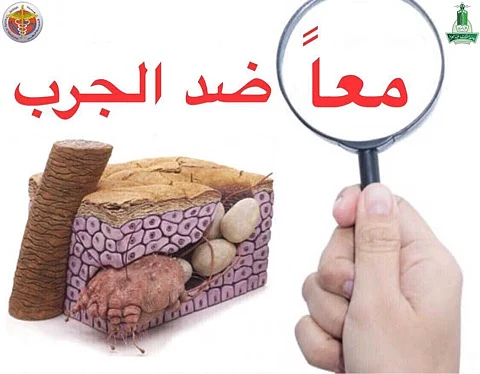 مستشفى جامعة المؤسس يطلق حملة "معًا ضد الجرب"