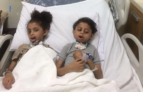 شاهد.. "سبق" تُنهي معاناة طفليْن وُلدا بفم ملتصق الفكين.. قصة مُحزنة انتهت بمشرط الجراح