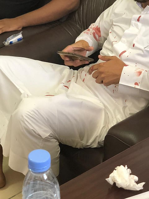 الطائف.. طالب ثانوي يُسدد لكمة دامية لوجه معلمه ويهرب! والسبب: السؤال عن اسمه؟