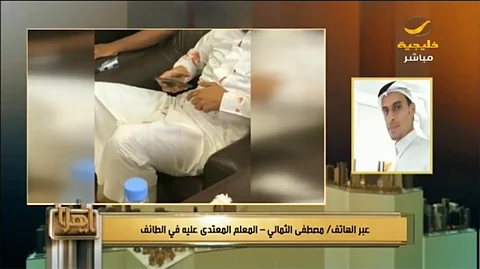 المعلم المعتدى عليه بالطائف: لن أتنازل عن حقي حتى يتوقف مسلسل حوادث الاعتداء علينا