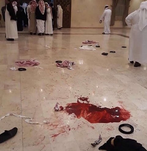 والد "العريس المطعون": ولي العهد وجَّه بنقل ابني للعلاج بأحد مستشفيات الرياض المتخصصة