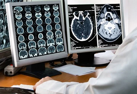 خريجو الأشعة التشخيصية يشكون من ندرة الوظائف بتخصصهم رغم أنهم "عين الطب"