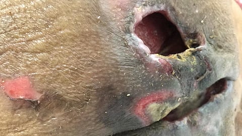 مواطنة: إهمال مستشفى بالباحة يتسبب في تعفن جروح والدتي.. والصحة تحقق