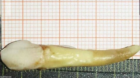 "أطول سن بشري في العالم".. كم طوله؟