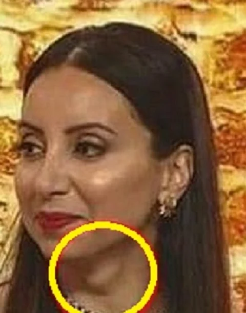 لقاء تلفزيوني كشف "كارثة" في رقبة المذيعة