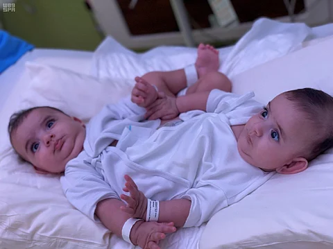 عملية الـ 15 ساعة.. 35 مختصًا يشاركون في فصل السيامي الليبي بعد غدٍ