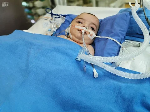 الربيعة: استقرار حالة السيامي الليبي وأحدهما يبدأ الرضاعة الطبيعية خلال يومين