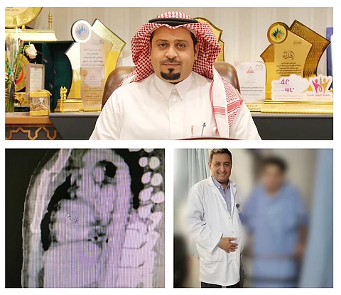 جراحات معقدة تنقذ مقيماً سقط من الطابق الثالث بعنيزة