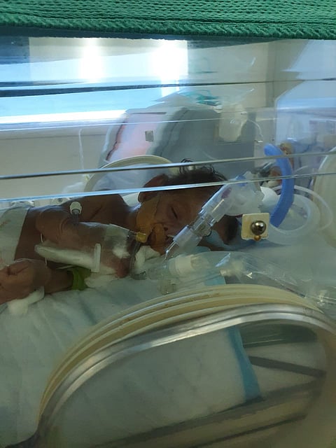 "سمو" تُلازم العناية المركزة بعسير منذ ولادتها.. ووالدها ينشد نقلها لمستشفى متخصص