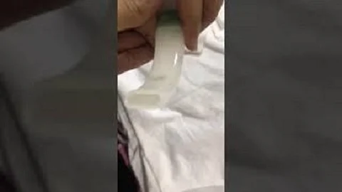 شاهد بالفيديو.. "دود" يخرج من أنبوب جهاز التنفس لمريضة بمستشفى بجدة