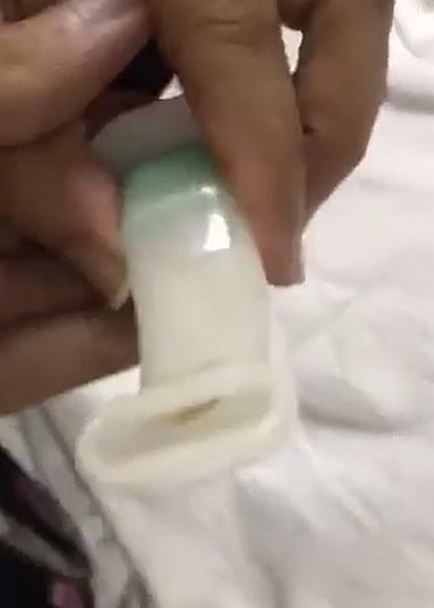 "صحة جدة" تكشف سبب "دود أنبوب تنفس مريضة الثغر": إنها "المذنبة"