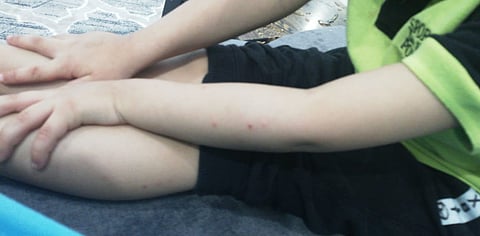 بلدي الرياض يؤكد تقرير "سبق": أكثر بلاغات البعوض رُصدت في "طويق"