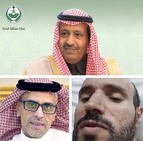 "صحة الباحة" تحقِّق في شكوى التنمُّر على مريض منوَّم من ذوي الإعاقة