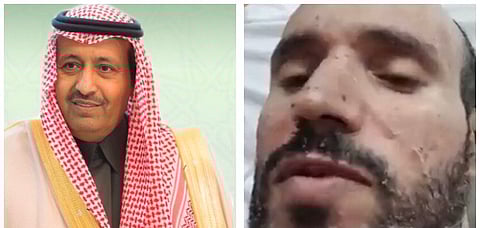أمير الباحة يوجه بتقصي الحقائق حول شكوى مريض من ذوي الإعاقة من تنمر التمريض