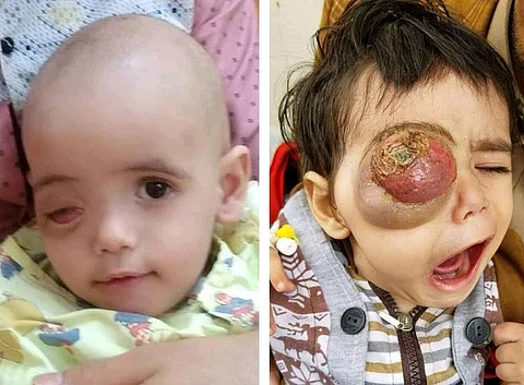 رحل "رواف" وبقيت إنسانية "ولي العهد".. هنا القصة كاملة وما قاله والده