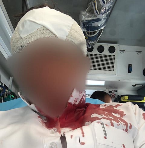 حدث يعايد "أخصائيًّا اجتماعيًّا" بطعنة خطيرة بالرأس صباح العيد بـ"ملاحظة أبها"