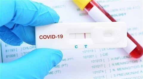 ليبيا تسجل 16 إصابة جديدة وحالة وفاة بفيروس كورونا