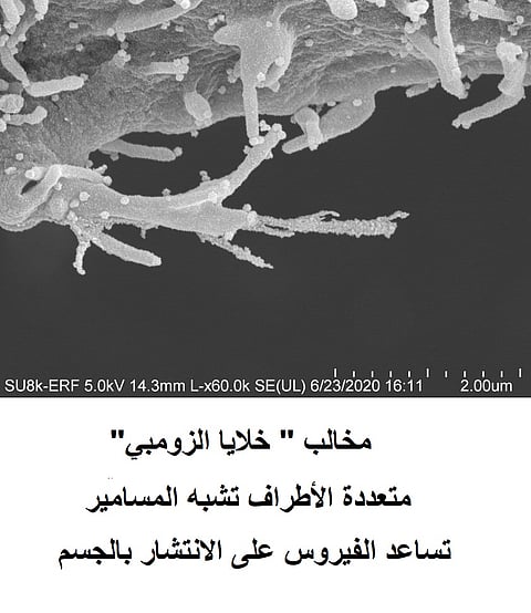 "خلايا الزومبي".. دراسة تكشف طريقة انتقال كورونا داخل الجسم