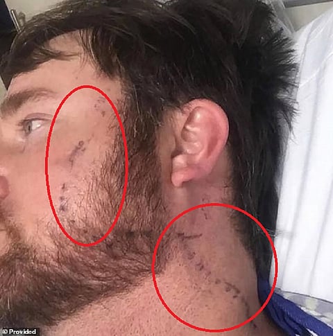 ضربته في رأسه.. شاهد حية الجرس تجلجل بالموت فوق شجرة