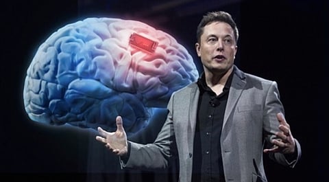 ربط العقل بالتقنية.. شريحة إيلون ماسك خيال علمي أم حقيقة مؤكدة الحدوث؟