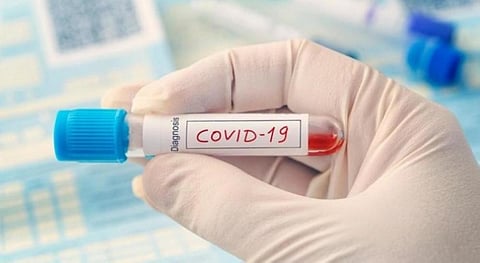 الهند تسجّل 79476 إصابة جديدة و1069 حالة وفاة بكورونا