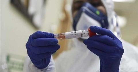 كورونا في فلسطين: 1158 إصابة جديدة بكورونا و11 وفاة و774 حالة تعافٍ