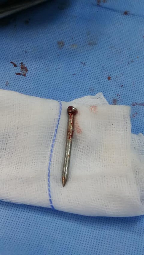 إنقاذ حياة عامل أصيب بمسمار بالشريان الأورطي بعد تدخل طبي في الطائف