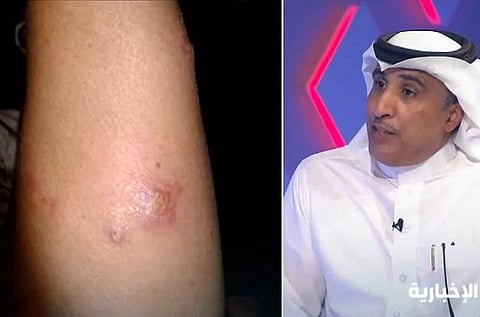 "الصحة": وضع منتزه "الثمامة" طبيعي.. "تقصينا" لا يوجد انتشار لمرض "الليشمانيا"