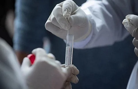 عدو البشرية.. الإصابات إلى 437 مليوناً والوفيات 5 ملايين و956 ألف وفاة