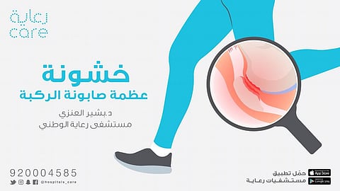 استشاري جراحة عظام يكشف أسباب خشونة "صابونة الركبة"