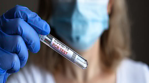 كورونا.. 165,890 إصابة جديدة بكوريا الجنوبية و1832 بمصر و1122 بباكستان