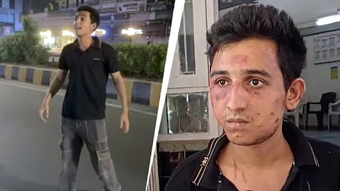 Vadodara Hit-Run Case : क्या बगल की सीट पर बैठे दोस्त को भी मिलेगी सजा?