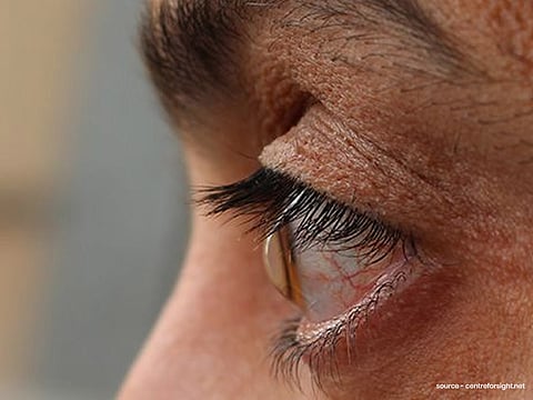 ‘रील’ देखने की लत दिमाग के साथ-साथ आखों को भी कर रही बीमार