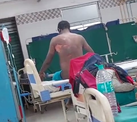 घायल व्यक्ति का अस्पताल में चल रहा इलाज
