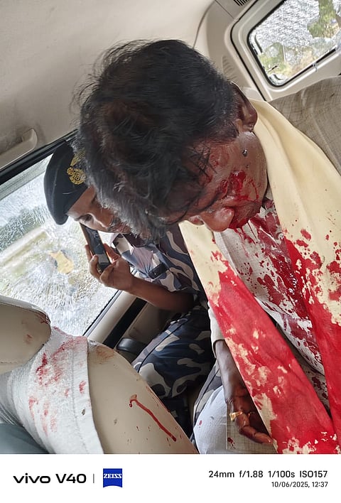 लहुलूहान भाजपा सांसद खगेन मुर्मू