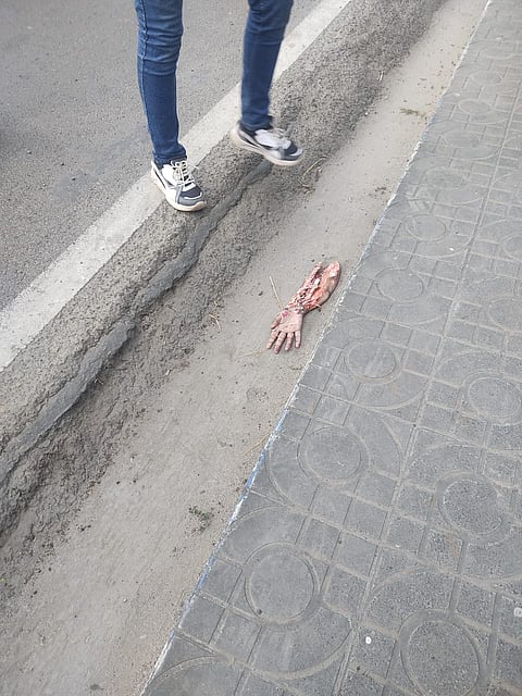 दुर्घटना के बाद सड़क पर पड़ा युवती का कटा हुआ हाथ