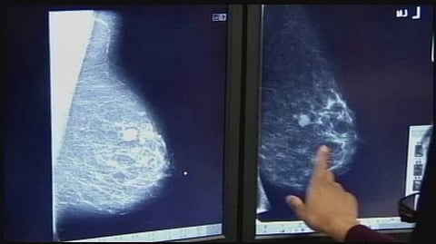 सांकेतिक चित्र