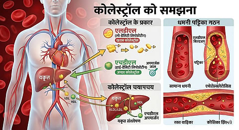 Cholesterol