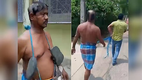 बंगाल में TMC नेता पर फूटा जनता का गुस्सा, सिर मुंडवाकर जूतों की माला पहनाई