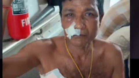 पहलगांव प्रधान पर जानलेवा हमला, शिकायतों से जुड़ा विवाद