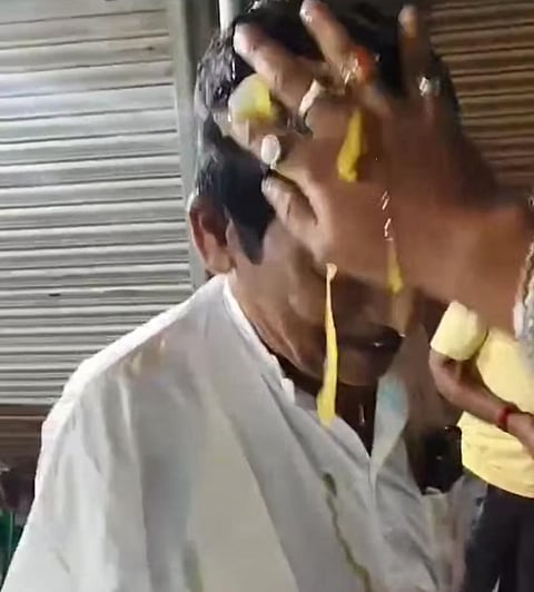 Viral Video: Howrah Ex Councillor Bishwanath Das Egg Therapy Protest News