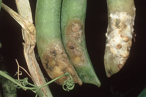 Killer Fungus Plant: कोराना के बाद कोलकाता में मिला किलर प्लांट फंगस का पहला केस, जानें क्या