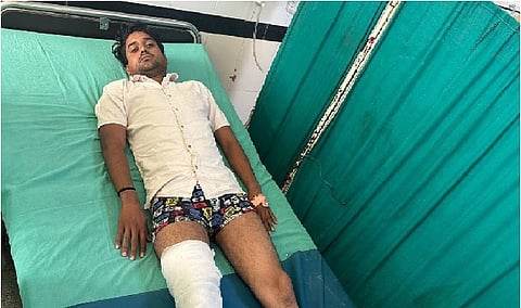 एनकाउंटर के दौरान घायल उपद्रवी