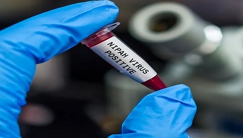 निपाह वायरस का बढ़ा खतरा