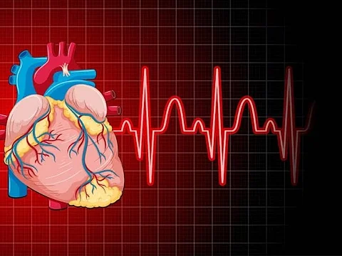 ECG कराना हमारे लिए है कितना जरूरी? आइए जानते हैं
