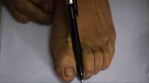 पैर से लिखकर छात्र ने दी थी 12वीं की परीक्षा, आए इतने % अंक…